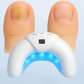 LumaNail LED Light Therapy System for Nails at Home
