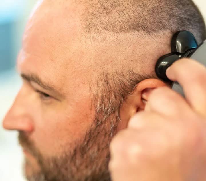 NovaTrim 5-i-1 trimmer med flytende hoder for en tett helkroppshårfjerning for menn