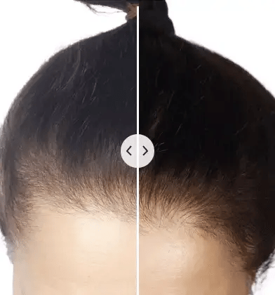 Pettine GlowFusion 5 in 1 con massaggio e terapia della luce per tutti i tipi di capelli