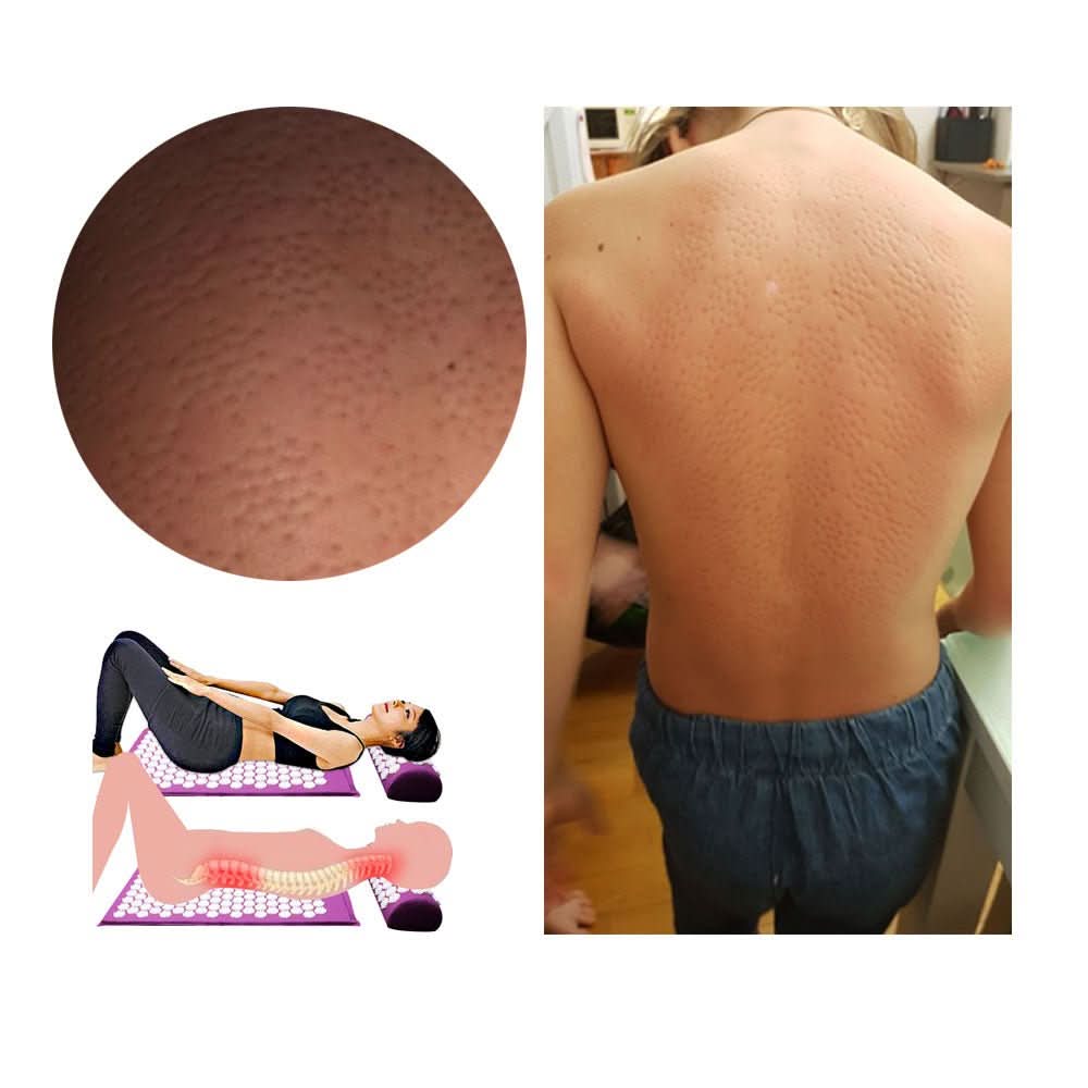 Set Tappetino Yoga e Cuscino CalmFlex per Agopressione e Sollievo Naturale dal Dolore a Casa