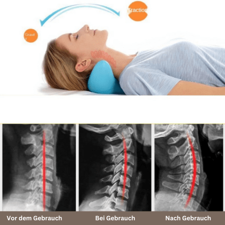 CalmEase ergonomikus nyakmasszázs párna a relaxációért és fájdalomcsillapításért