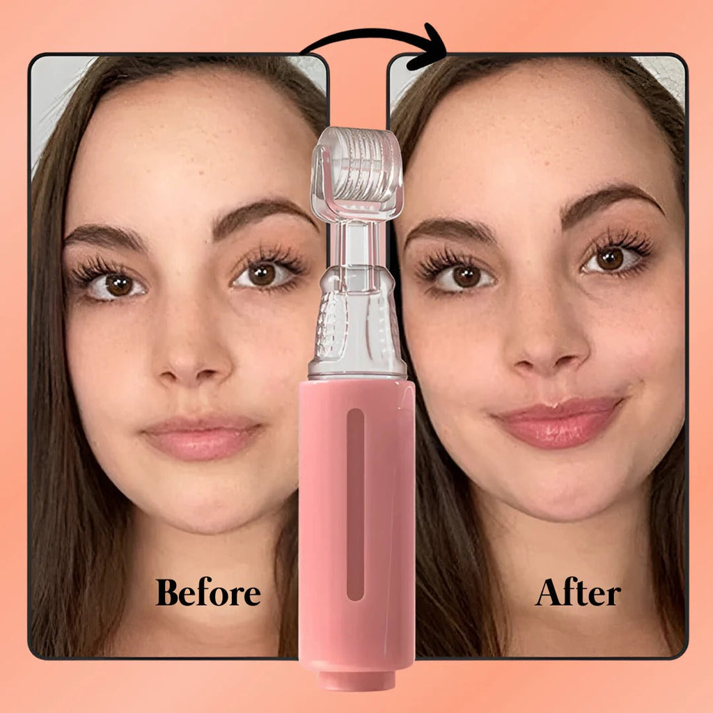 Lip Booster Kit - Gentle Natural Lip Plumper