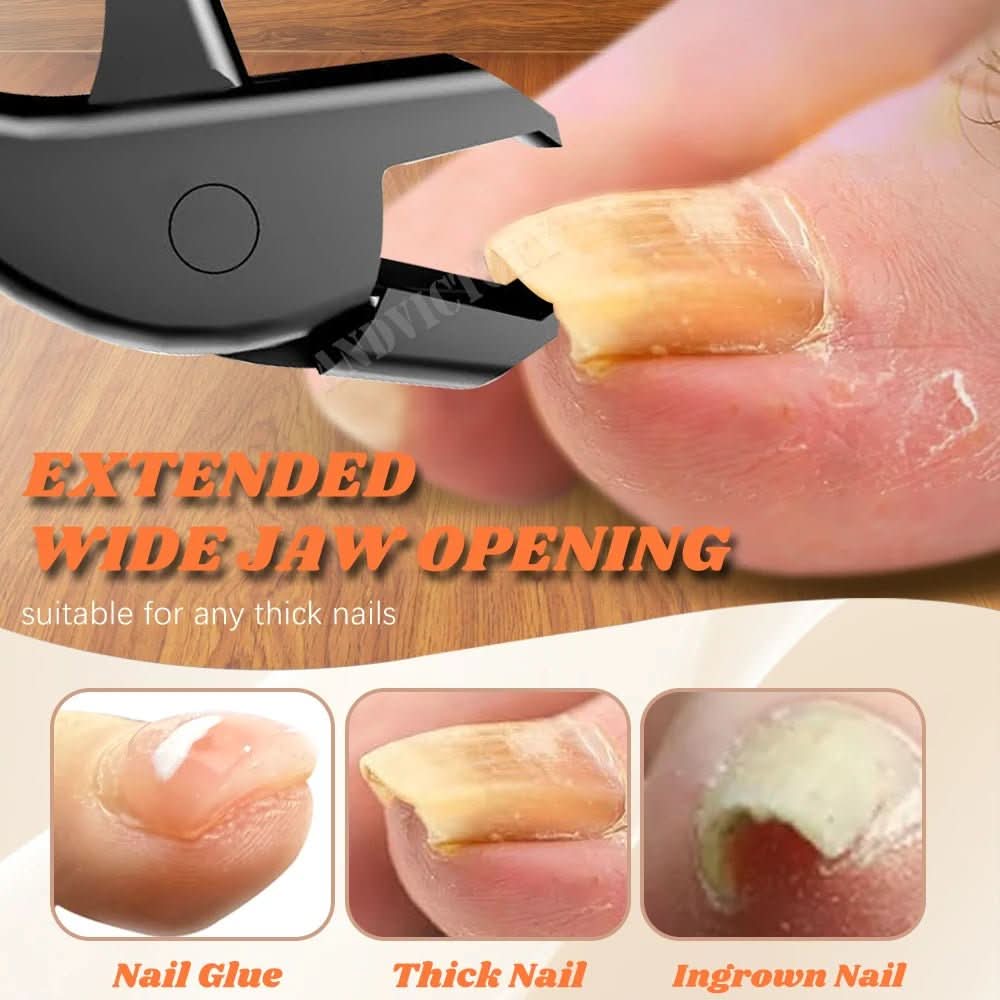 NovaCare Präzisions-Nagelknipser für mühelose Pflege