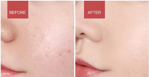 LumaPure Electric Facial Cleanser With LED Light And 42 Celsius Heat
