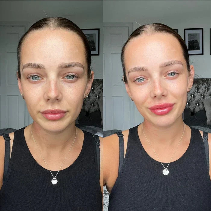 Øjeblikkeligt læbefyldende serum