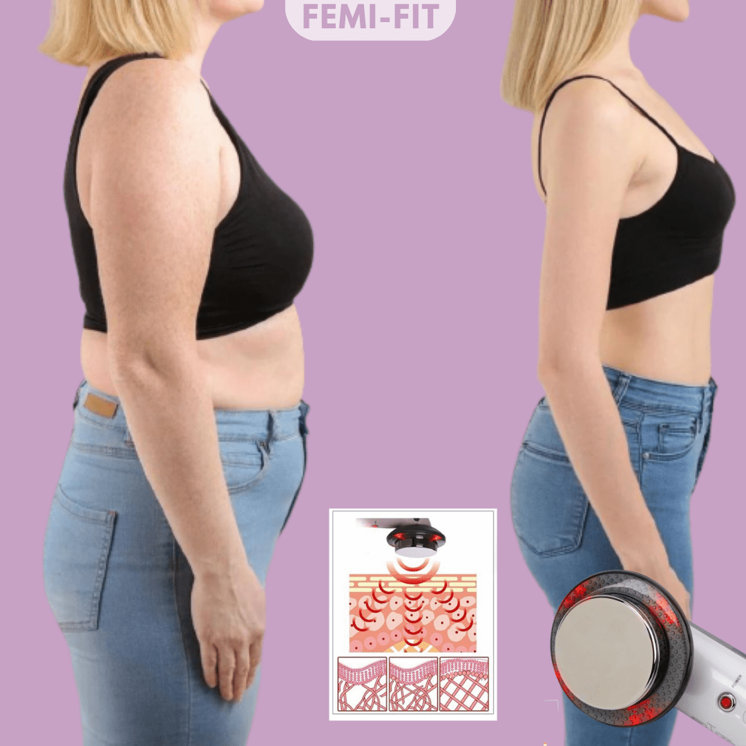 NovaSculpt 3en1 Quemador de Celulitis y Grasa con EMS, Ultrasonido e Infrarrojo para Uso Doméstico