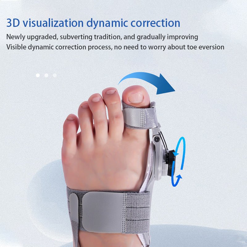 Hallux Helper: Gentle Bunion Realignment for Painless Walking