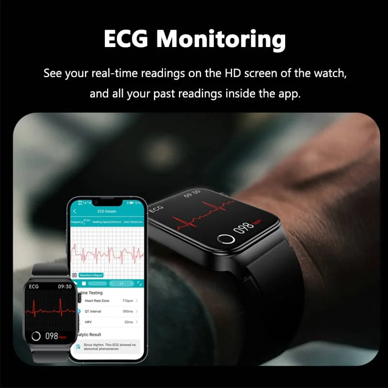Alt-i-en sundhedsovervågningssmartwatch med EKG og blodsukkertracker