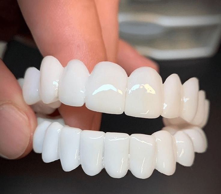 FLEXIDENT természetes hatású héj a mindennapi magabiztosságért