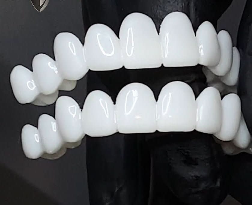 FLEXIDENT természetes hatású héj a mindennapi magabiztosságért